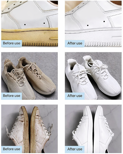 White Shoes Stains Cleaning Cream